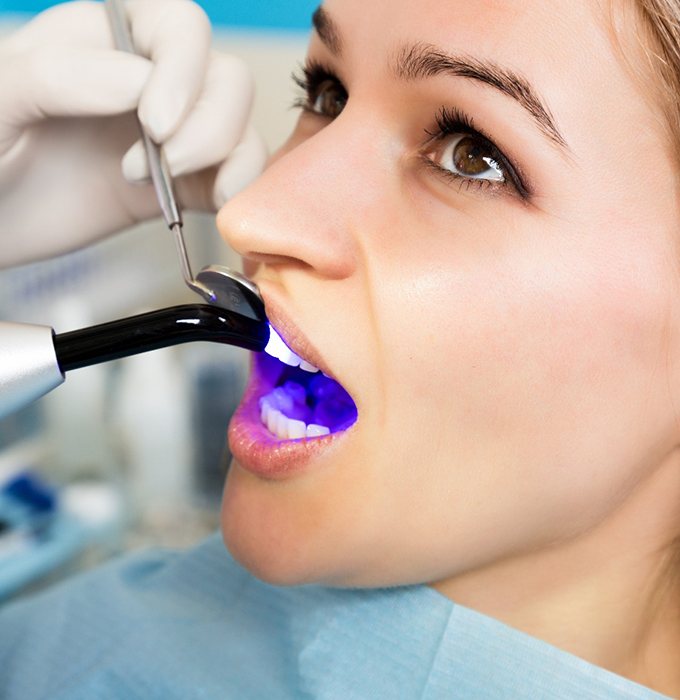 Dentist applying UV light to woman’s dental bonding