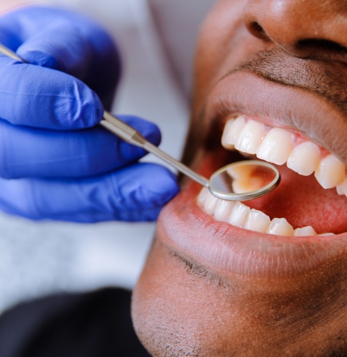 Dentist checking patient's tooth colored fillings