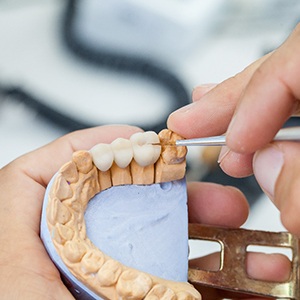 Dental crown being produced