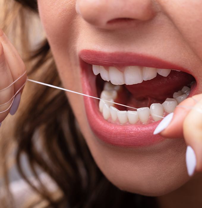 Woman flossing teeth to prevent dental emergencies