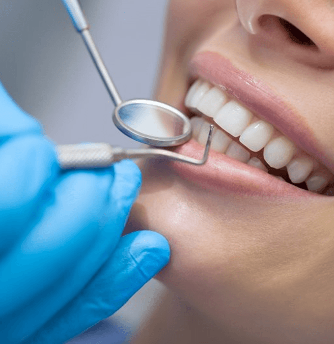 a patient having their tooth-colored fillings checked