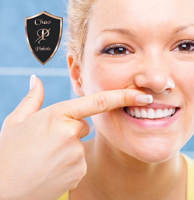 Woman looking at her healthy gums after Chao Pinhole Surgical technique treatment