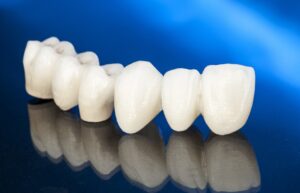 Porcelain dental bridge on blue background