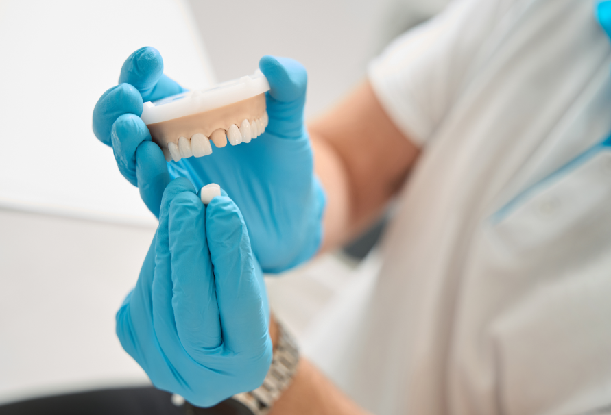 Dentist holding model dental crown