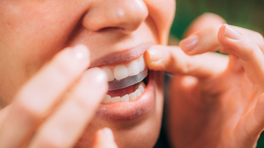 Closeup of someone applying whitening strip to upper teeth